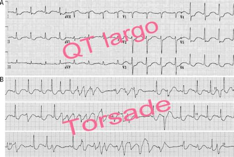 Qt 4 8 Sinal De Fenda