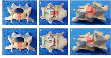 Ventral Slot Procedimento